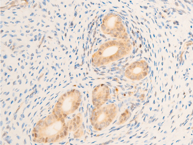 MAP3K7 / TAK1 Antibody - 1:100 staining rat uterine tissue by IHC-P. The tissue was formaldehyde fixed and a heat mediated antigen retrieval step in citrate buffer was performed. The tissue was then blocked and incubated with the antibody for 1.5 hours at 22°C. An HRP conjugated goat anti-rabbit antibody was used as the secondary.