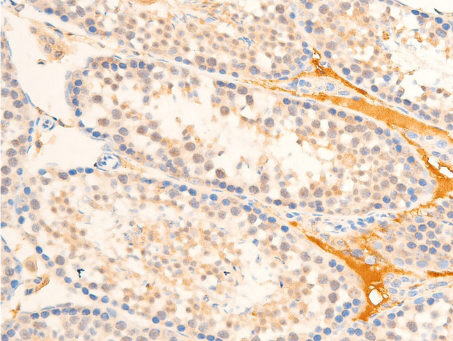 MAP3K7 / TAK1 Antibody - 1:100 staining mouse testis tissue by IHC-P. The tissue was formaldehyde fixed and a heat mediated antigen retrieval step in citrate buffer was performed. The tissue was then blocked and incubated with the antibody for 1.5 hours at 22°C. An HRP conjugated goat anti-rabbit antibody was used as the secondary.