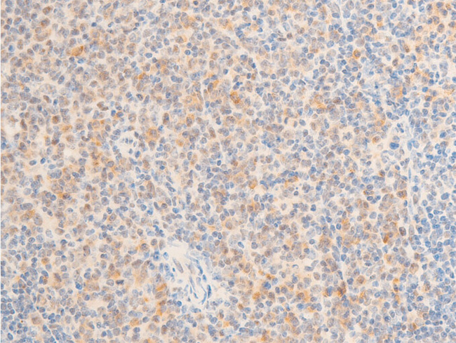 MAP3K7 / TAK1 Antibody - 1:100 staining mouse spleen tissue by IHC-P. The tissue was formaldehyde fixed and a heat mediated antigen retrieval step in citrate buffer was performed. The tissue was then blocked and incubated with the antibody for 1.5 hours at 22°C. An HRP conjugated goat anti-rabbit antibody was used as the secondary.