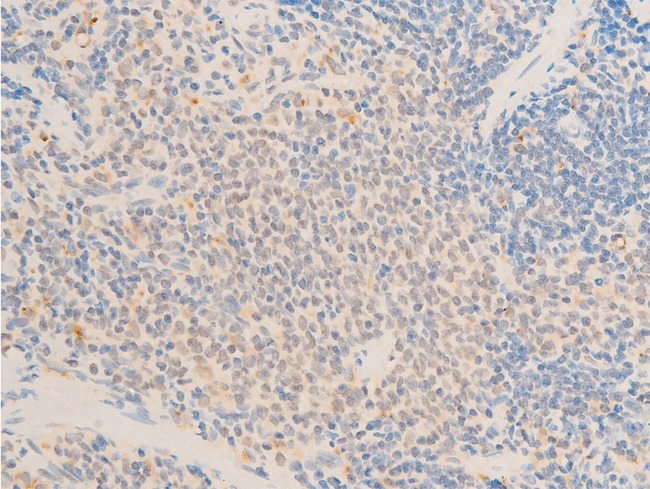 MAP3K7 / TAK1 Antibody - 1:100 staining rat spleen tissue by IHC-P. The tissue was formaldehyde fixed and a heat mediated antigen retrieval step in citrate buffer was performed. The tissue was then blocked and incubated with the antibody for 1.5 hours at 22°C. An HRP conjugated goat anti-rabbit antibody was used as the secondary.