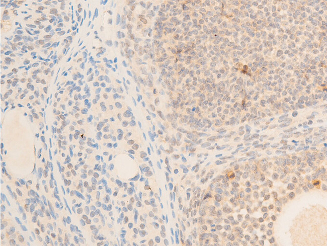 MAP3K7 / TAK1 Antibody - 1:100 staining rat ovarian tissue by IHC-P. The tissue was formaldehyde fixed and a heat mediated antigen retrieval step in citrate buffer was performed. The tissue was then blocked and incubated with the antibody for 1.5 hours at 22°C. An HRP conjugated goat anti-rabbit antibody was used as the secondary.