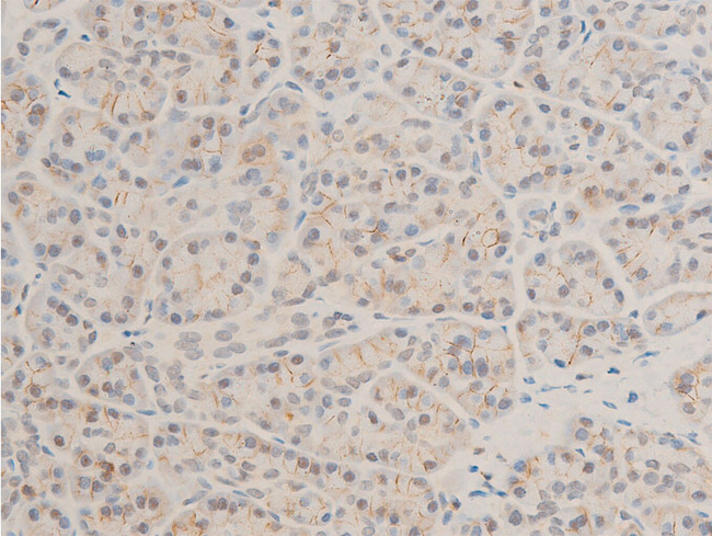 MAP3K7 / TAK1 Antibody - 1:100 staining human pancreas tissue by IHC-P. The tissue was formaldehyde fixed and a heat mediated antigen retrieval step in citrate buffer was performed. The tissue was then blocked and incubated with the antibody for 1.5 hours at 22°C. An HRP conjugated goat anti-rabbit antibody was used as the secondary.