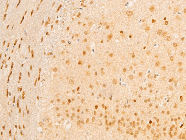 MAP3K7 / TAK1 Antibody - 1:100 staining mouse brain tissue by IHC-P. The tissue was formaldehyde fixed and a heat mediated antigen retrieval step in citrate buffer was performed. The tissue was then blocked and incubated with the antibody for 1.5 hours at 22°C. An HRP conjugated goat anti-rabbit antibody was used as the secondary.