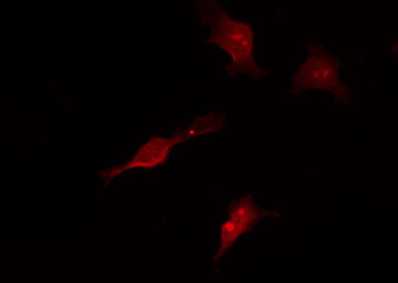 MAP3K7 / TAK1 Antibody - Staining HepG2 cells by IF/ICC. The samples were fixed with PFA and permeabilized in 0.1% Triton X-100, then blocked in 10% serum for 45 min at 25°C. The primary antibody was diluted at 1:200 and incubated with the sample for 1 hour at 37°C. An Alexa Fluor 594 conjugated goat anti-rabbit IgG (H+L) Ab, diluted at 1/600, was used as the secondary antibody.