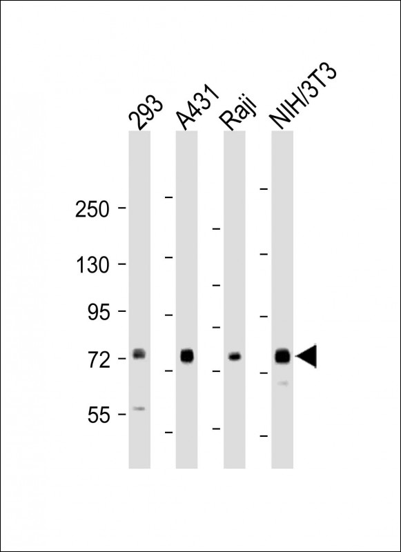 MAP3K7 / TAK1 Antibody - All lanes: Anti-TAK1 (Ser439) Antibody at 1:1000-1:2000 dilution Lane 1: 293 whole cell lysate Lane 2: A431 whole cell lysate Lane 3: Raji whole cell lysate Lane 4: NIH/3T3 whole cell lysate Lysates/proteins at 20 µg per lane. Secondary Goat Anti-Rabbit IgG, (H+L), Peroxidase conjugated at 1/10000 dilution. Predicted band size: 67 kDa Blocking/Dilution buffer: 5% NFDM/TBST.