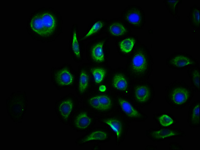 MAP3K7CL / TAK1L Antibody - Immunofluorescence staining of A549 cells with MAP3K7CL Antibody at 1:133, counter-stained with DAPI. The cells were fixed in 4% formaldehyde, permeabilized using 0.2% Triton X-100 and blocked in 10% normal Goat Serum. The cells were then incubated with the antibody overnight at 4°C. The secondary antibody was Alexa Fluor 488-congugated AffiniPure Goat Anti-Rabbit IgG(H+L).