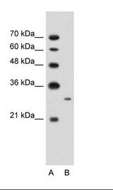 MAP3K7CL / TAK1L Antibody - A: Marker, B: Jurkat Cell Lysate.  This image was taken for the unconjugated form of this product. Other forms have not been tested.