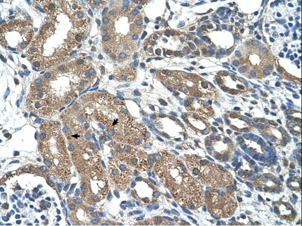 MAP3K7CL / TAK1L Antibody - C21orf7 antibody ARP42552_T100-NP_064537-C21ORF7 Antibody was used in IHC to stain formalin-fixed, paraffin-embedded human kidney.  This image was taken for the unconjugated form of this product. Other forms have not been tested.