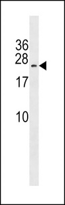 MAP3K7CL / TAK1L Antibody - TAK1L Antibody western blot of CEM cell line lysates (35 ug/lane). The TAK1L antibody detected the TAK1L protein (arrow).