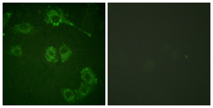 MAP3K8 / TPL2 Antibody - Immunofluorescence analysis of HUVEC cells, using COT Antibody. The picture on the right is blocked with the synthesized peptide.