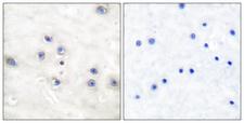 MAP3K8 / TPL2 Antibody - Immunohistochemistry analysis of paraffin-embedded human brain tissue, using COT Antibody. The picture on the right is blocked with the synthesized peptide.