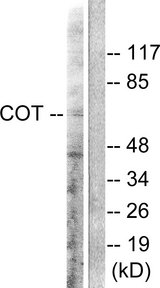 MAP3K8 / TPL2 Antibody - Western blot analysis of lysates from 293 cells, treated with LPS 100ng/ml 30', using COT Antibody. The lane on the right is blocked with the synthesized peptide.