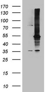 MAP3K8 / TPL2 Antibody - HEK293T cells were transfected with the pCMV6-ENTRY control. (Left lane) or pCMV6-ENTRY MAP3K8. (Right lane) cDNA for 48 hrs and lysed. Equivalent amounts of cell lysates. (5 ug per lane) were separated by SDS-PAGE and immunoblotted with anti-MAP3K8. (1:500)