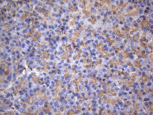 MAP3K8 / TPL2 Antibody - Immunohistochemical staining of paraffin-embedded Human pancreas tissue within the normal limits using anti-MAP3K8 mouse monoclonal antibody. (Heat-induced epitope retrieval by 1mM EDTA in 10mM Tris buffer. (pH8.5) at 120°C for 3 min. (1:150)