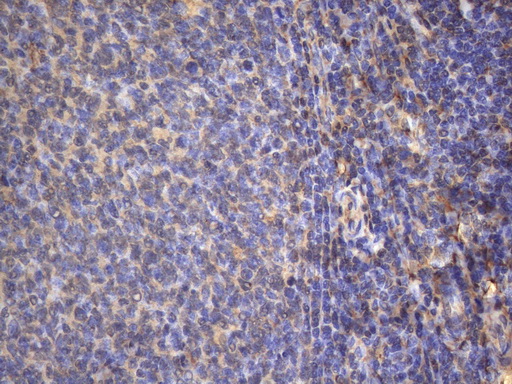 MAP3K8 / TPL2 Antibody - Immunohistochemical staining of paraffin-embedded Human tonsil within the normal limits using anti-MAP3K8 mouse monoclonal antibody. (Heat-induced epitope retrieval by 1mM EDTA in 10mM Tris buffer. (pH8.5) at 120°C for 3 min. (1:150)