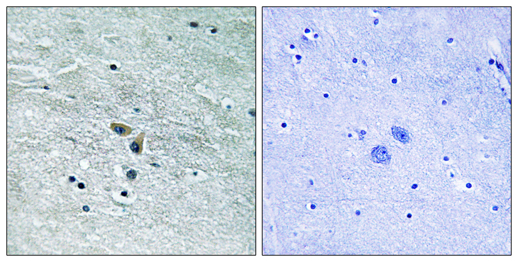 MAP3K8 / TPL2 Antibody - Immunohistochemistry analysis of paraffin-embedded human brain tissue, using MAP3K8 Antibody. The picture on the right is blocked with the synthesized peptide.