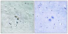 MAP3K8 / TPL2 Antibody - Immunohistochemistry analysis of paraffin-embedded human brain tissue, using MAP3K8 Antibody. The picture on the right is blocked with the synthesized peptide.