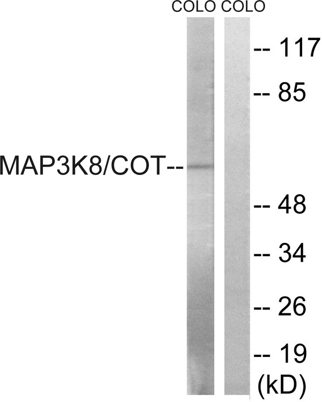 MAP3K8 / TPL2 Antibody - Western blot analysis of lysates from COLO205 cells, treated with Insulin 0.01U/ml 15', using MAP3K8 Antibody. The lane on the right is blocked with the synthesized peptide.