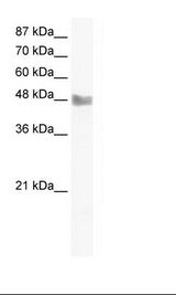 MAP3K8 / TPL2 Antibody - Jurkat Cell Lysate.  This image was taken for the unconjugated form of this product. Other forms have not been tested.