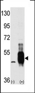 MAP3K8 / TPL2 Antibody - Western blot of MEKK8 (arrow) using MEKK8 Antibody. 293 cell lysates (2 ug/lane) either nontransfected (Lane 1) or transiently transfected with the MAP3K8 gene (Lane 2) (Origene Technologies).