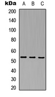 MAP3K8 / TPL2 Antibody - Western blot analysis of TPL2 expression in HEK293T (A); mouse brain (B); rat liver (C) whole cell lysates.