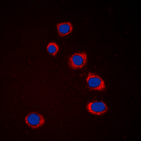 MAP3K8 / TPL2 Antibody - Immunofluorescent analysis of TPL2 staining in HEK293T cells. Formalin-fixed cells were permeabilized with 0.1% Triton X-100 in TBS for 5-10 minutes and blocked with 3% BSA-PBS for 30 minutes at room temperature. Cells were probed with the primary antibody in 3% BSA-PBS and incubated overnight at 4 deg C in a humidified chamber. Cells were washed with PBST and incubated with a DyLight 594-conjugated secondary antibody (red) in PBS at room temperature in the dark. DAPI was used to stain the cell nuclei (blue).