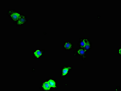 MAP3K8 / TPL2 Antibody - Immunofluorescent analysis of Hela cells using MAP3K8 Antibody at dilution of 1:100 and Alexa Fluor 488-congugated AffiniPure Goat Anti-Rabbit IgG(H+L)