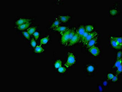 MAP3K8 / TPL2 Antibody - Immunofluorescent analysis of HepG2 cells using MAP3K8 Antibody at dilution of 1:100 and Alexa Fluor 488-congugated AffiniPure Goat Anti-Rabbit IgG(H+L)
