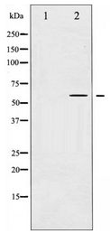 MAP3K8 / TPL2 Antibody - Western blot of COT expression in LPS treated 293 whole cell lysates,The lane on the left is treated with the antigen-specific peptide.