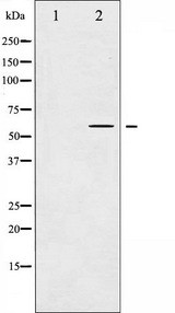 MAP3K8 / TPL2 Antibody - Western blot analysis of COT expression in LPS treated 293 whole cells lysates. The lane on the left is treated with the antigen-specific peptide.