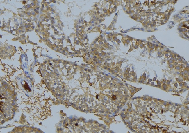 MAP3K8 / TPL2 Antibody - 1:100 staining mouse testis tissue by IHC-P. The sample was formaldehyde fixed and a heat mediated antigen retrieval step in citrate buffer was performed. The sample was then blocked and incubated with the antibody for 1.5 hours at 22°C. An HRP conjugated goat anti-rabbit antibody was used as the secondary.