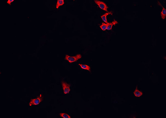 MAP3K8 / TPL2 Antibody - Staining HeLa cells by IF/ICC. The samples were fixed with PFA and permeabilized in 0.1% Triton X-100, then blocked in 10% serum for 45 min at 25°C. The primary antibody was diluted at 1:200 and incubated with the sample for 1 hour at 37°C. An Alexa Fluor 594 conjugated goat anti-rabbit IgG (H+L) antibody, diluted at 1/600, was used as secondary antibody.