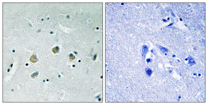 MAP3K8 / TPL2 Antibody - Immunohistochemistry analysis of paraffin-embedded human brain, using MAP3K8 (Phospho-Ser400) Antibody. The picture on the right is blocked with the phospho peptide.