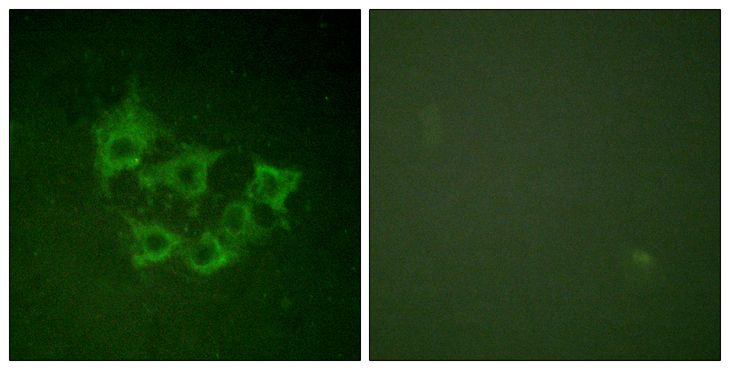 MAP3K8 / TPL2 Antibody - Immunofluorescence analysis of HUVEC cells, using COT (Phospho-Thr290) Antibody. The picture on the right is blocked with the phospho peptide.