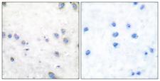 MAP3K8 / TPL2 Antibody - Immunohistochemistry analysis of paraffin-embedded human brain, using COT (Phospho-Thr290) Antibody. The picture on the right is blocked with the phospho peptide.