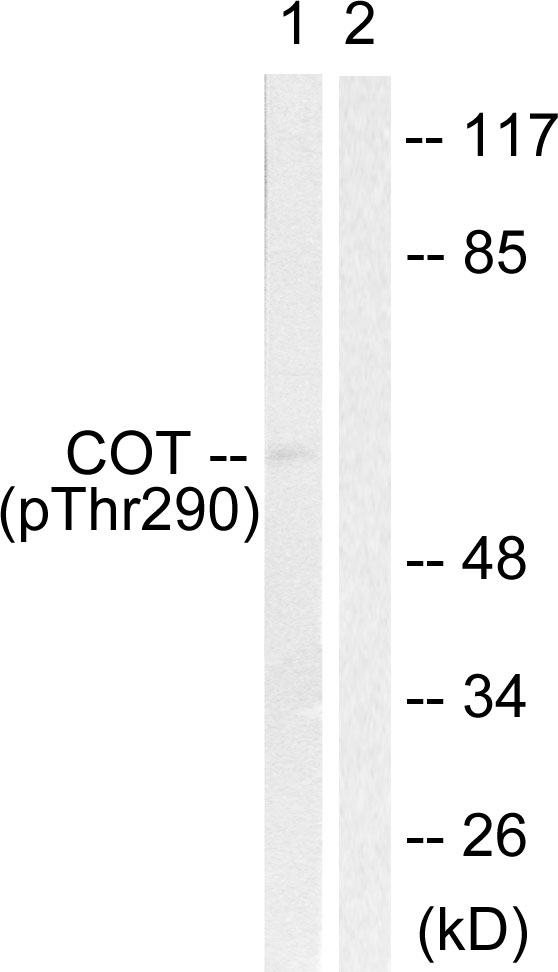 MAP3K8 / TPL2 Antibody - Western blot analysis of lysates from 293 cells treated with UV 15', using COT (Phospho-Thr290) Antibody. The lane on the right is blocked with the phospho peptide.