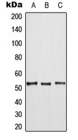 MAP3K8 / TPL2 Antibody - Western blot analysis of TPL2 (pT290) expression in HepG2 (A); mouse liver (B); rat liver (C) whole cell lysates.