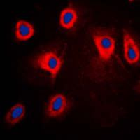 MAP3K8 / TPL2 Antibody - Immunofluorescent analysis of TPL2 (pT290) staining in HepG2 cells. Formalin-fixed cells were permeabilized with 0.1% Triton X-100 in TBS for 5-10 minutes and blocked with 3% BSA-PBS for 30 minutes at room temperature. Cells were probed with the primary antibody in 3% BSA-PBS and incubated overnight at 4 C in a humidified chamber. Cells were washed with PBST and incubated with a DyLight 594-conjugated secondary antibody (red) in PBS at room temperature in the dark. DAPI was used to stain the cell nuclei (blue).