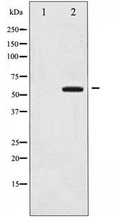MAP3K8 / TPL2 Antibody - Western blot of COT phosphorylation expression in UV treated 293 whole cell lysates,The lane on the left is treated with the antigen-specific peptide.