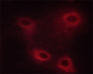 MAP3K8 / TPL2 Antibody - Staining HuvEc cells by IF/ICC. The samples were fixed with PFA and permeabilized in 0.1% saponin prior to blocking in 10% serum for 45 min at 37°C. The primary antibody was diluted 1/400 and incubated with the sample for 1 hour at 37°C. A Alexa Fluor 594 conjugated goat polyclonal to rabbit IgG (H+L), diluted 1/600 was used as secondary antibody.