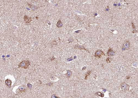 MAP3K8 / TPL2 Antibody - 1:100 staining human brain tissue by IHC-P. The tissue was formaldehyde fixed and a heat mediated antigen retrieval step in citrate buffer was performed. The tissue was then blocked and incubated with the antibody for 1.5 hours at 22°C. An HRP conjugated goat anti-rabbit antibody was used as the secondary.