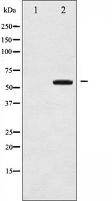 MAP3K8 / TPL2 Antibody - Western blot analysis of COT phosphorylation expression in UV treated 293 whole cells lysates. The lane on the left is treated with the antigen-specific peptide.
