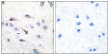 MAP3K8 / TPL2 Antibody - P-peptide - + Immunohistochemical analysis of paraffin-embedded human brain tissue using COT (phospho-Thr290) antibody.