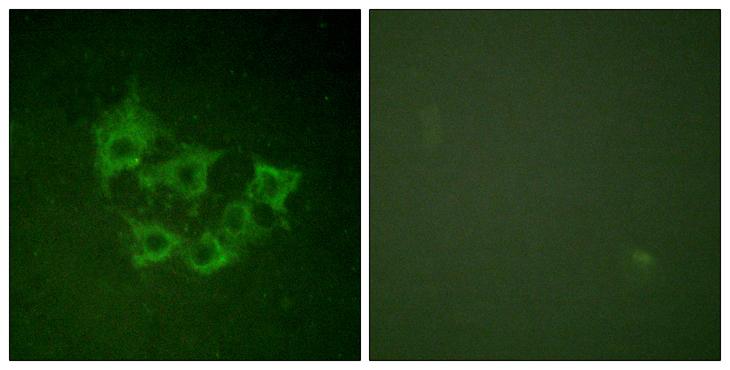 MAP3K8 / TPL2 Antibody - P-peptide - + Immunofluorescence analysis of HuvEc cells, using COT (phospho-Thr290) antibody.