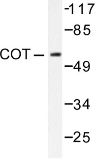 MAP3K8 / TPL2 Antibody - Western blot of COT (P284) pAb in extracts from 293 treated with LPS 100ng/ml 30' cells.