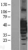 MAP3K8 / TPL2 Protein - Western validation with an anti-DDK antibody * L: Control HEK293 lysate R: Over-expression lysate