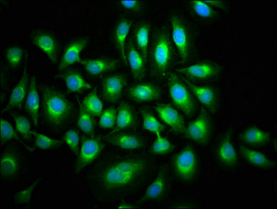 MAP3K9 / MLK1 Antibody - Immunofluorescence staining of A549 cells with MAP3K9 Antibody at 1:133, counter-stained with DAPI. The cells were fixed in 4% formaldehyde, permeabilized using 0.2% Triton X-100 and blocked in 10% normal Goat Serum. The cells were then incubated with the antibody overnight at 4°C. The secondary antibody was Alexa Fluor 488-congugated AffiniPure Goat Anti-Rabbit IgG(H+L).