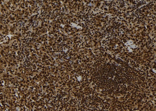 MAP3K9 / MLK1 Antibody - 1:100 staining mouse spleen tissue by IHC-P. The sample was formaldehyde fixed and a heat mediated antigen retrieval step in citrate buffer was performed. The sample was then blocked and incubated with the antibody for 1.5 hours at 22°C. An HRP conjugated goat anti-rabbit antibody was used as the secondary.