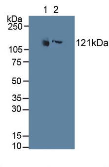 MAP4 Antibody - Western Blot; Sample: Lane1: Porcine Testis Tissue; Lane2: Rat Prostate Gland Tissue.