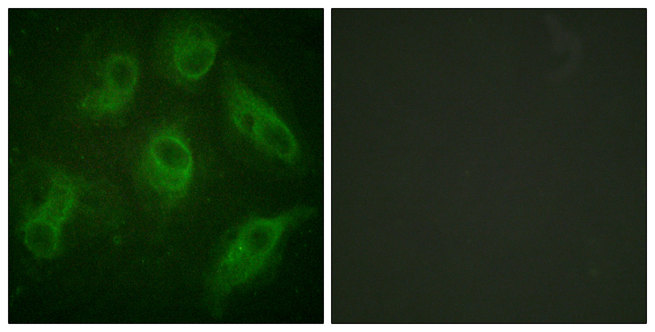 MAP4 Antibody - Immunofluorescence analysis of HeLa cells, using MAP4 Antibody. The picture on the right is blocked with the synthesized peptide.